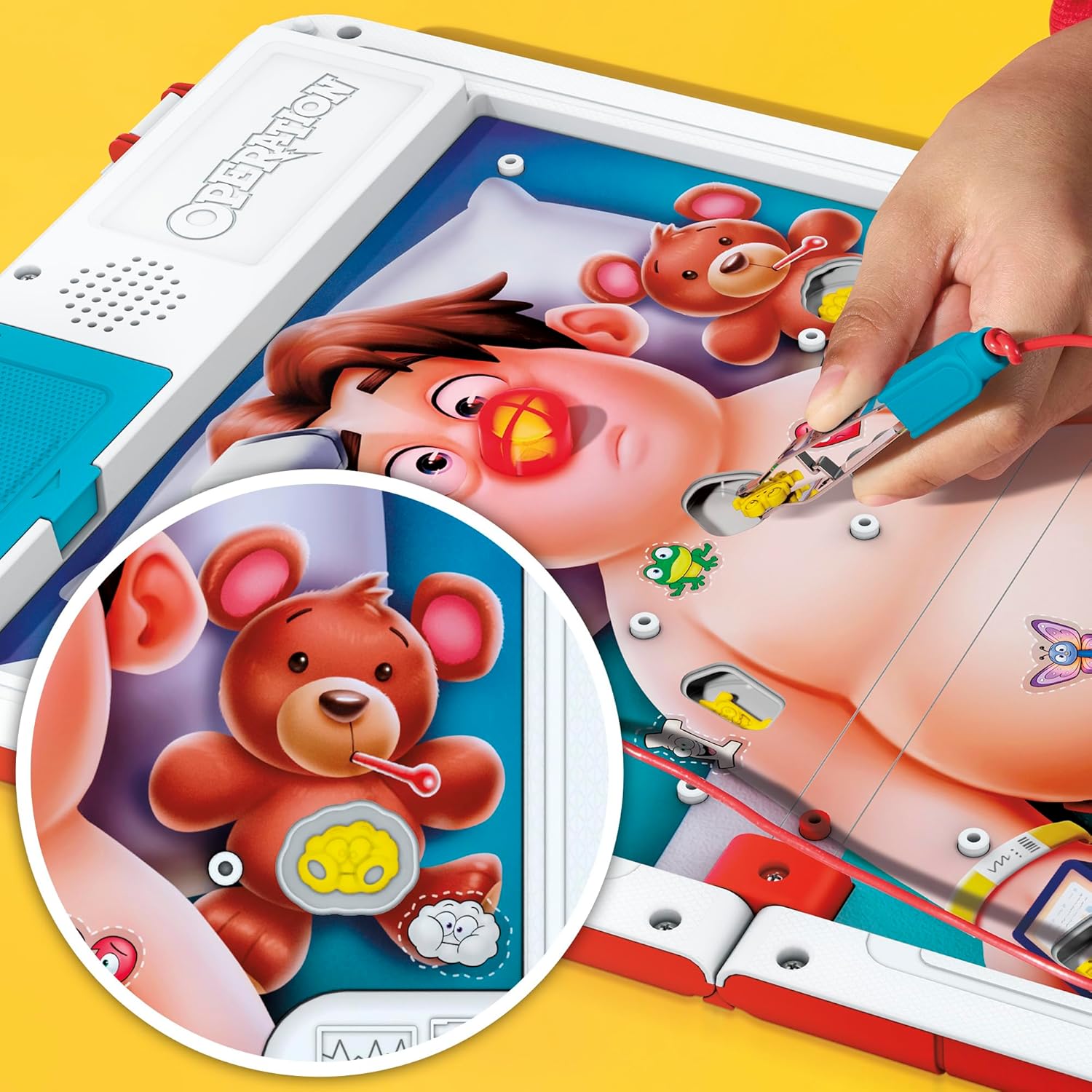 Operation Electronic Board Game with All-in-One Carrying Case For Kids Ages 6+